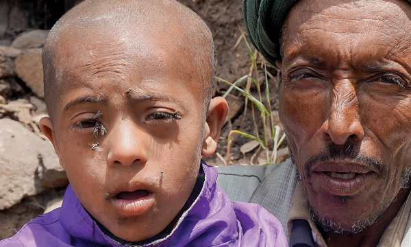 Portrait of Fekadu, a child benefiting from healing programs